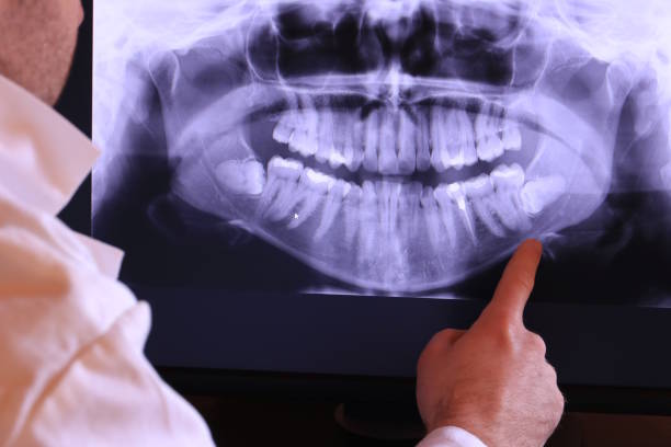 Best Dentist for Tooth Abscess  in Orwell, OH