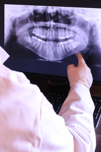 Best Broken Tooth Emergency  in Orwell, OH