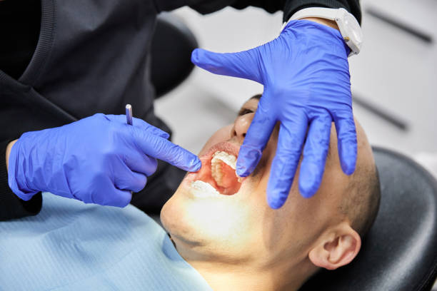 Best Chipped Tooth Repair Near Me  in Orwell, OH