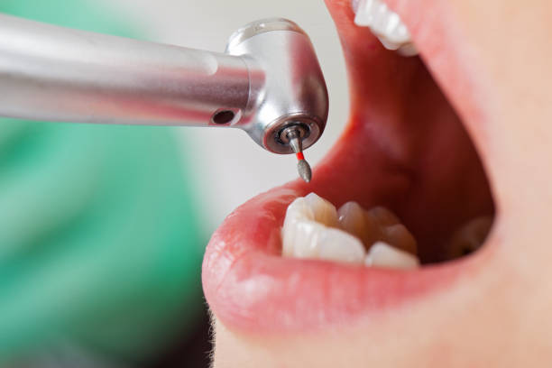 Best Emergency Tooth Extraction  in Orwell, OH